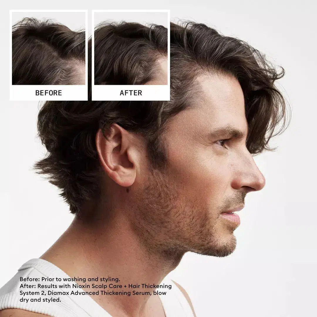 Scalp + Hair Conditioner System 2 Conditioner - Image 5