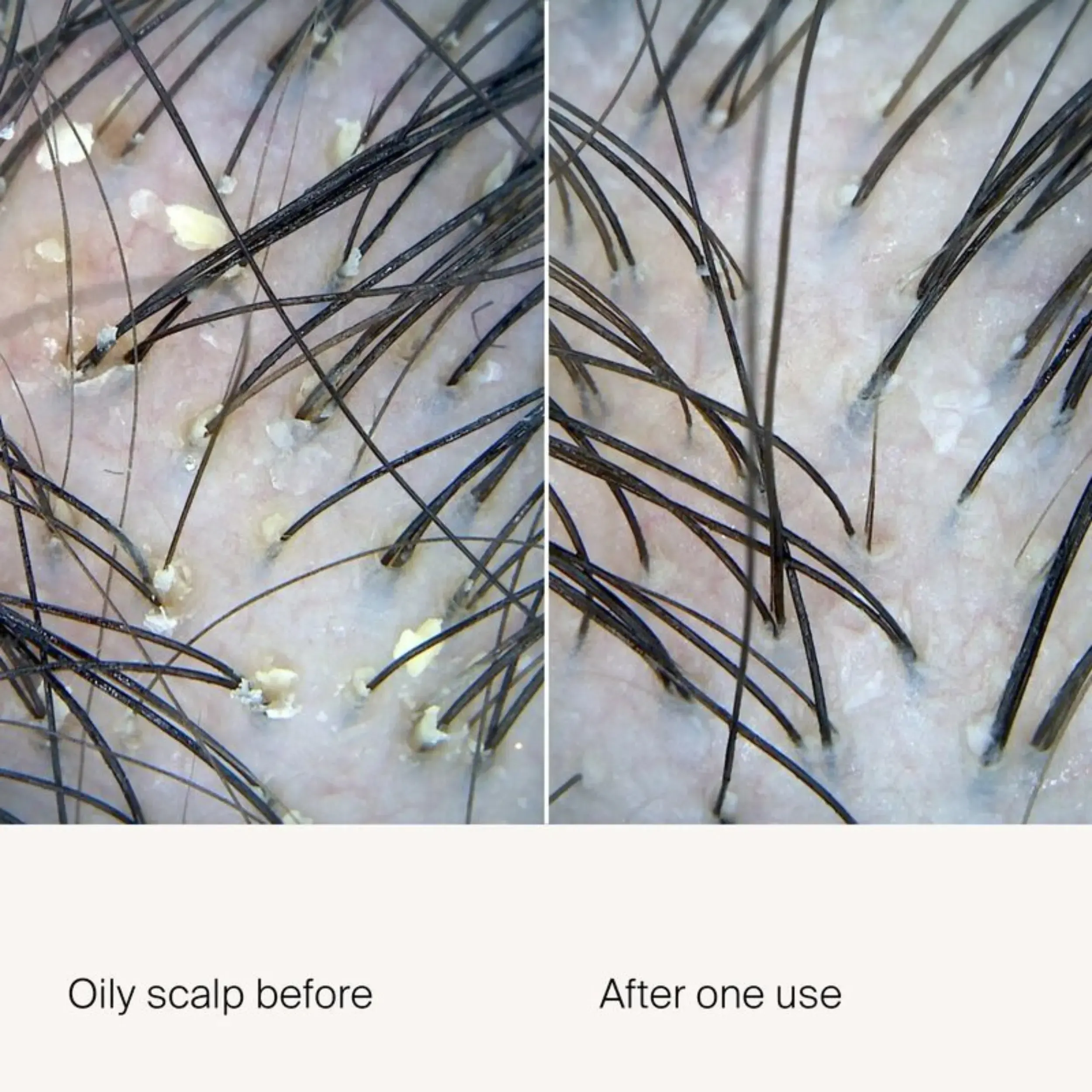 Scalp Care Exfoliator - Image 3