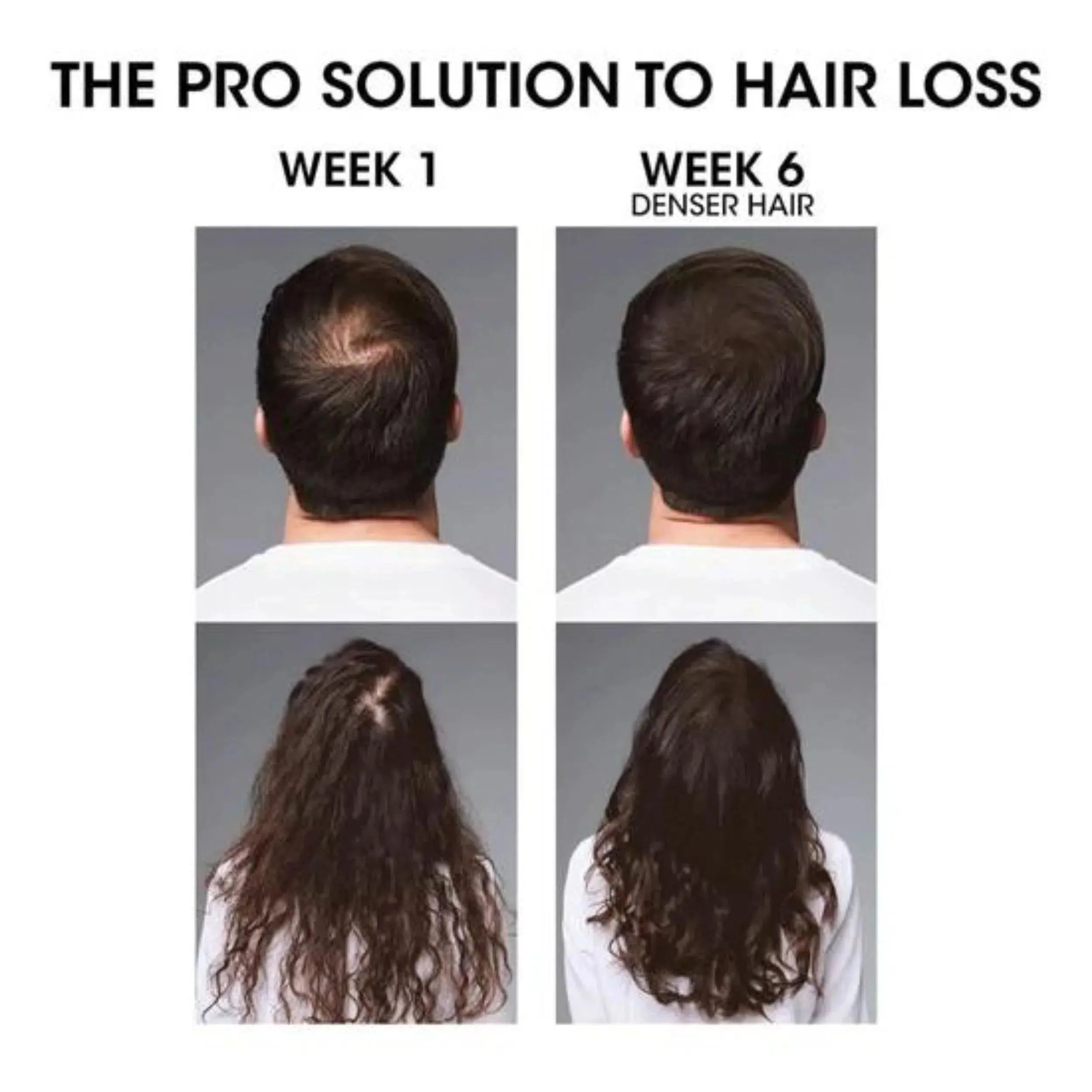 Serioxyl Denser Hair Serum - Image 4